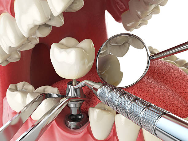 Best 24-Hour Emergency Dentist in Lincoln Center, KS